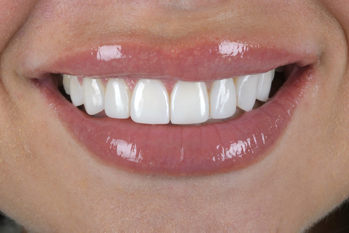 Patient at the dentist